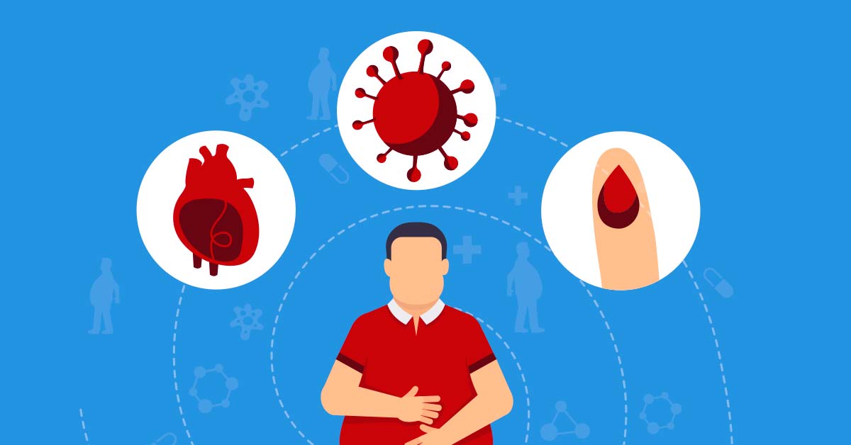 Obesidad, hipertensión y diabetes en la pandemia por Covid-19