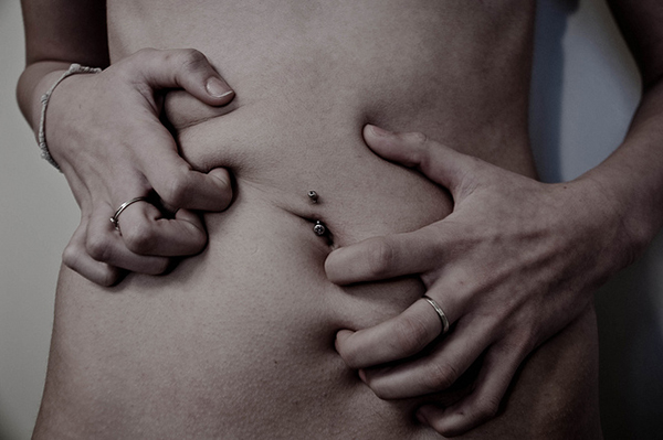 anorexia anorexia