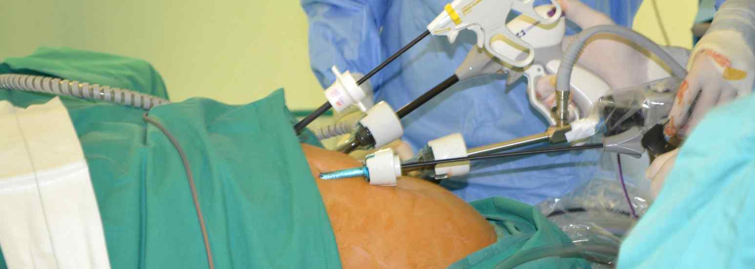 Intervención quirúrgica por laparoscopia