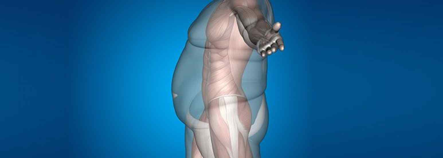 clasificacion de la obesidad