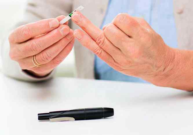 diabetes cirugia bariatrica obesidad