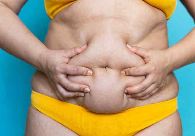 evolucion-cirugia-en-obesidad-grado-1